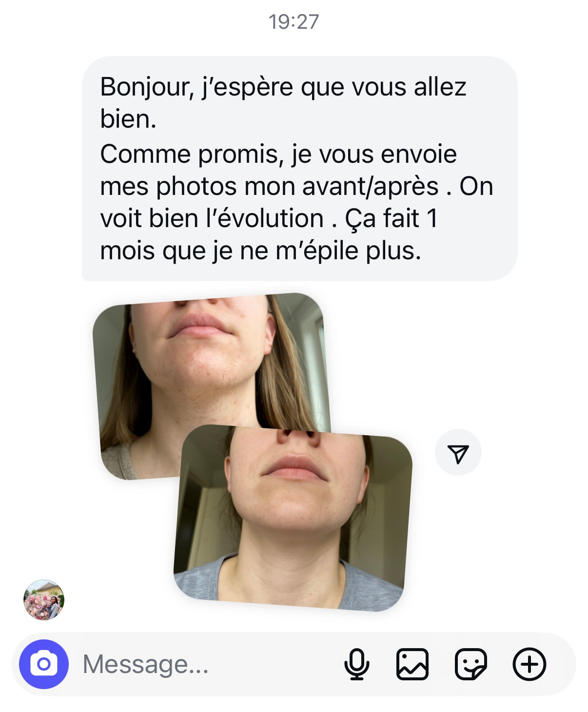 MelaGlow - Épilateur IPL adapté aux peaux claires à foncées